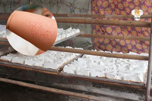 Bột sắn dây trị rôm sảy cho bé