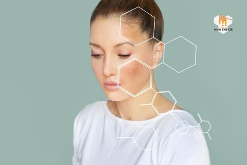 Tác Dụng Của Bột Sắn Dây Đối Với Sức Khỏe Và Làn Da