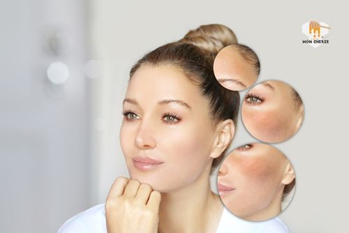 Những Lợi Ích Khác Của Bột Sắn Dây Đối Với Làn Da