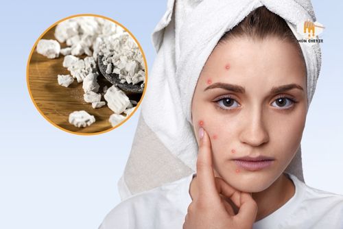 Cách uống bột sắn dây trị mụn